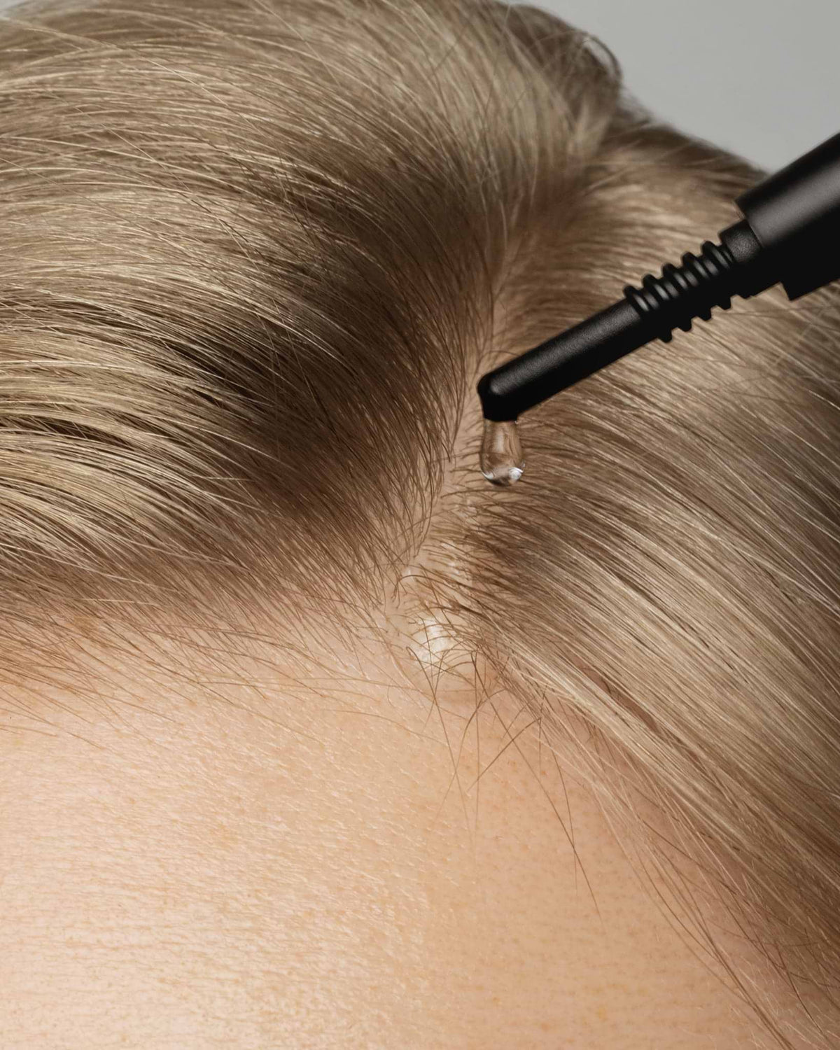 Hair Loss Explained: How Topical Products Can Slow Shedding and Restore Scalp Balance
