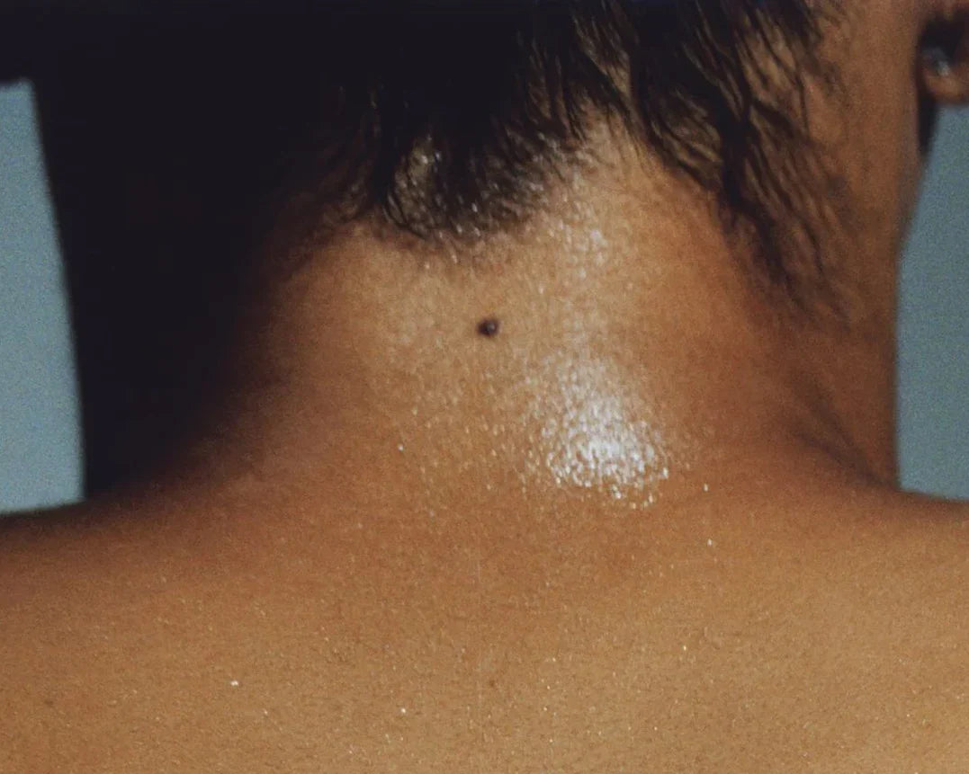 Men’s Skincare After the Gym: How to Protect Your Skin Post-Workout
